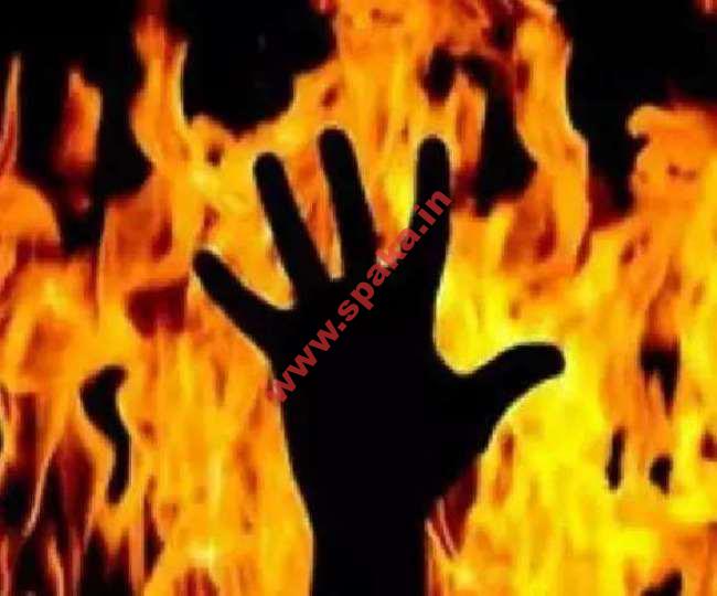 हिमाचल : लव मैरिज का अंतः ‘पत्नी ने तेल फंका, सास ने लगाई आग’, ससुरालियों ने दामाद को जलाया